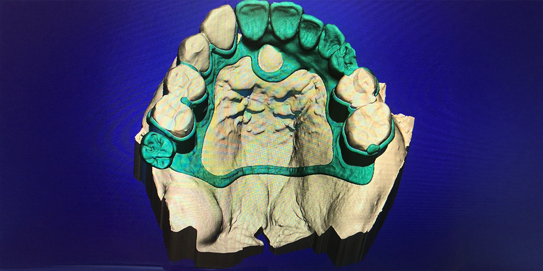 アタッチメント構造